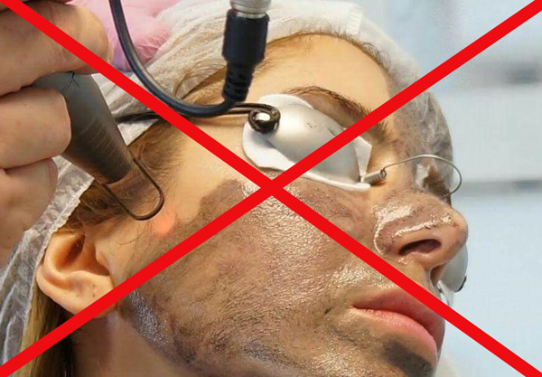 Interdiction après une thérapie botulique