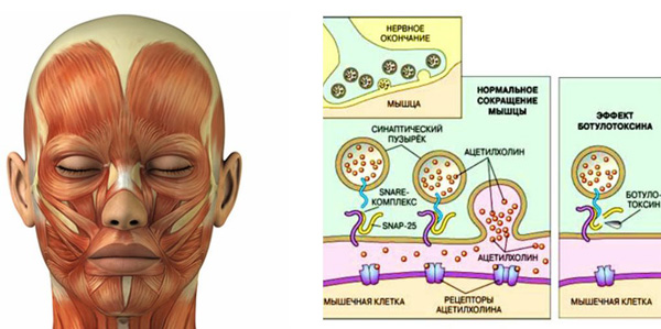 L'effet de la toxine botulique sur les muscles