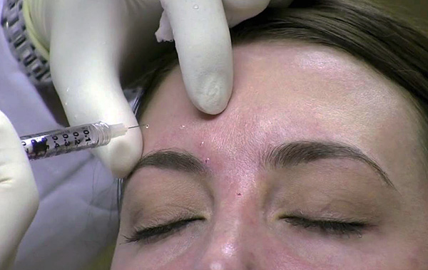 Certains médicaments, par opposition à la toxine botulique, entraînent des tensions musculaires.