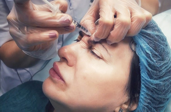 L'introduction de la toxine botulique dans le muscle