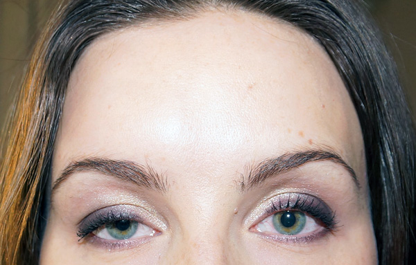 Ptose de la paupière supérieure