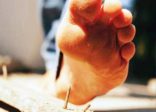 Percer les jambes avec un clou