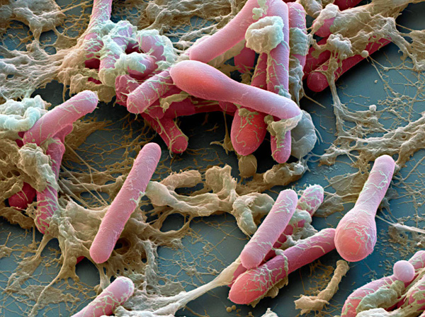 Agent causal du botulisme