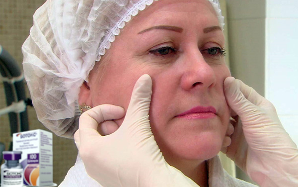 Plus les rides sont profondes, plus il faut d'unités de médicament pour les éliminer.