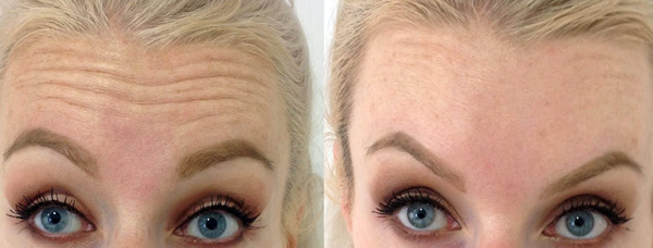 Effet de sourcil de Méphistophélès