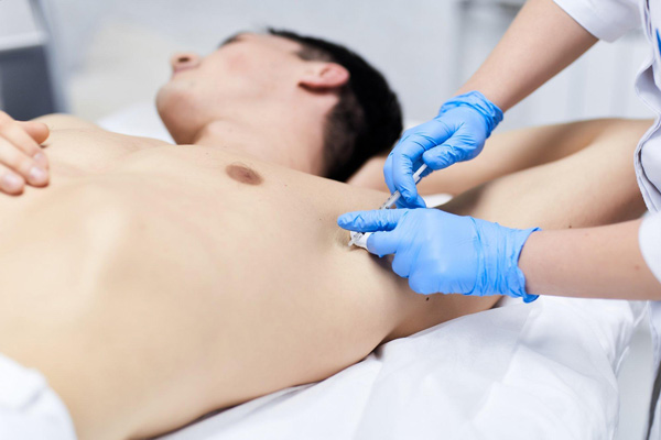 Traitement de l'hyperhidrose avec des préparations de toxine botulique