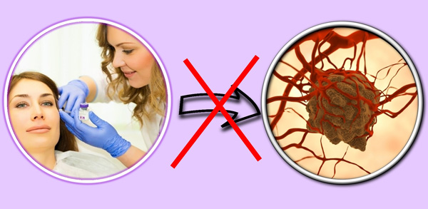 L'introduction de préparations de toxine botulique ne peut pas provoquer le développement d'un cancer