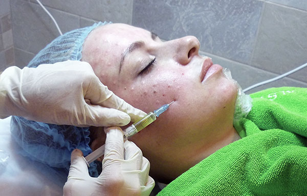 Biorévitalisation de l'acide hyaluronique