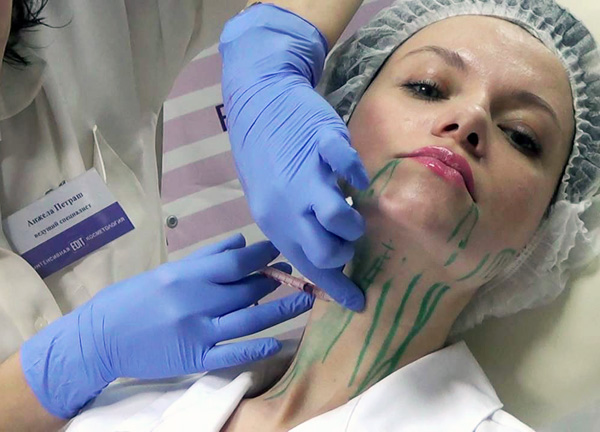 Lors de la correction des contours du visage avec Botox, la précision de l'administration du médicament est importante.