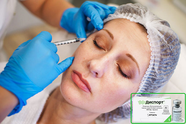 Le résultat après les injections de Dysport dure de 5 à 8 mois